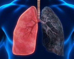 СИЛ ҲАТМАН ТАБОБАТ МЕШАВАД, НАБОЯД НОУМЕД ГАРДИД!